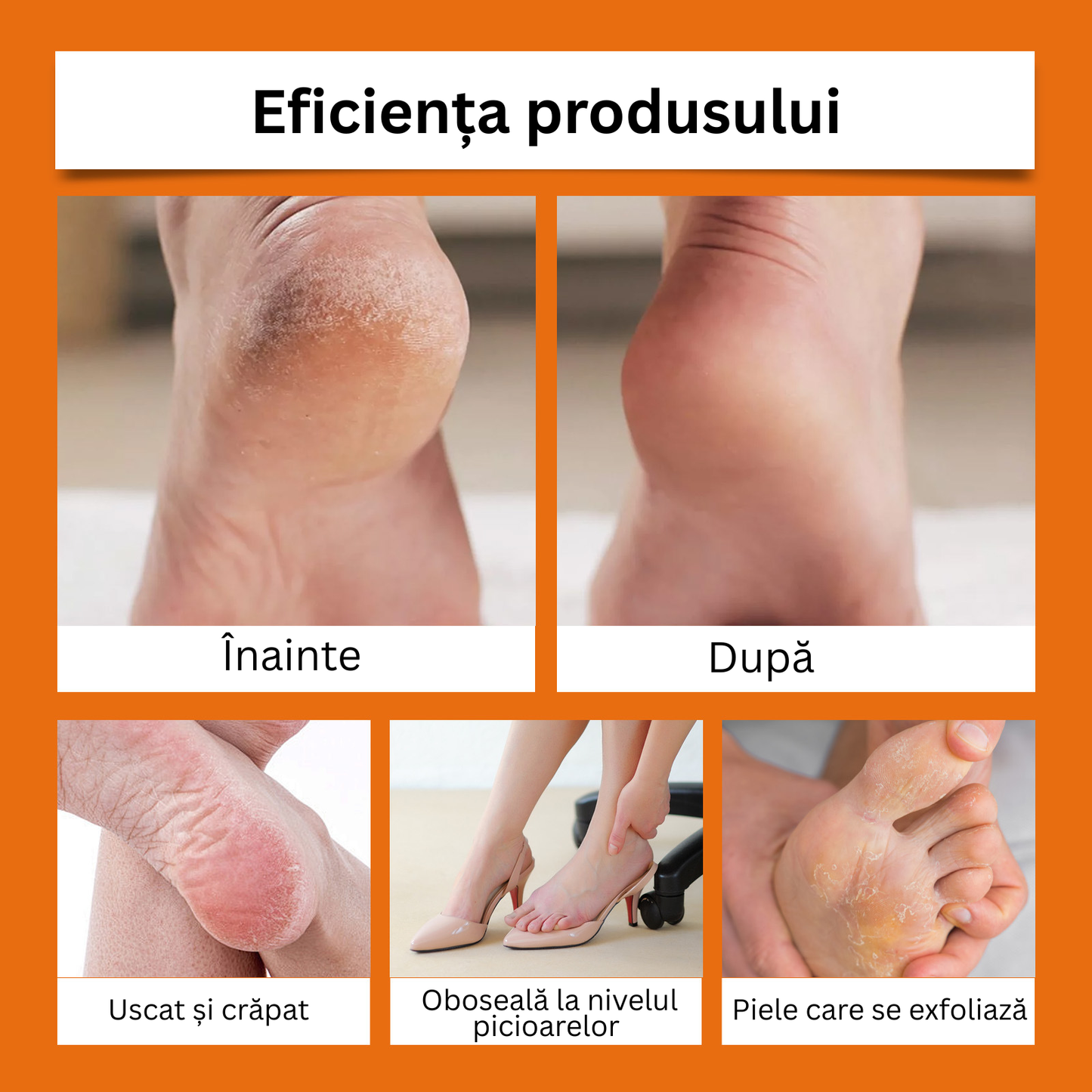 Stick Hidratant pentru Călcâie și Mâini Crăpate